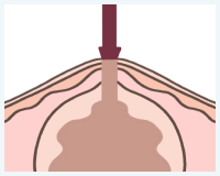 STEP2 パンチで穴を開けるイメージ