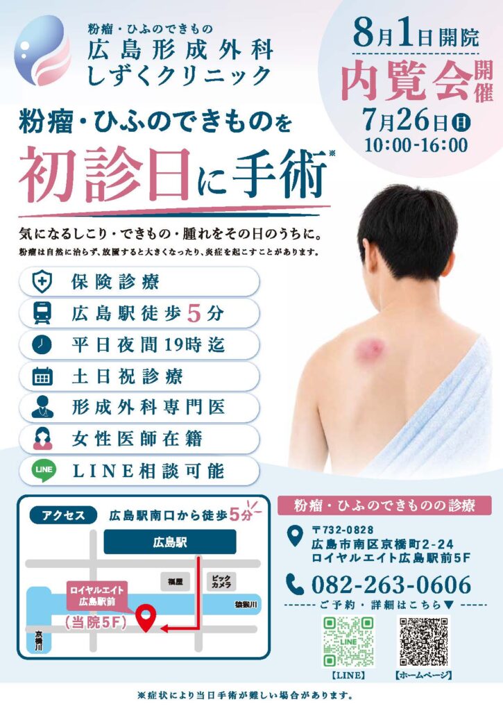 しずくクリニック内覧会チラシ