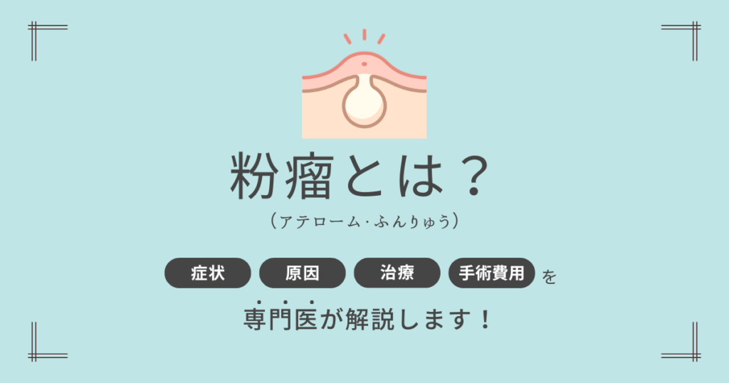 粉瘤とは？アイキャッチ画像