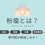 粉瘤とは？アイキャッチ画像