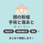 顔の粉瘤を治すには？手術の選び方と傷あとの経過・費用