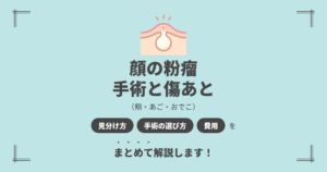 顔の粉瘤を治すには？手術の選び方と傷あとの経過・費用